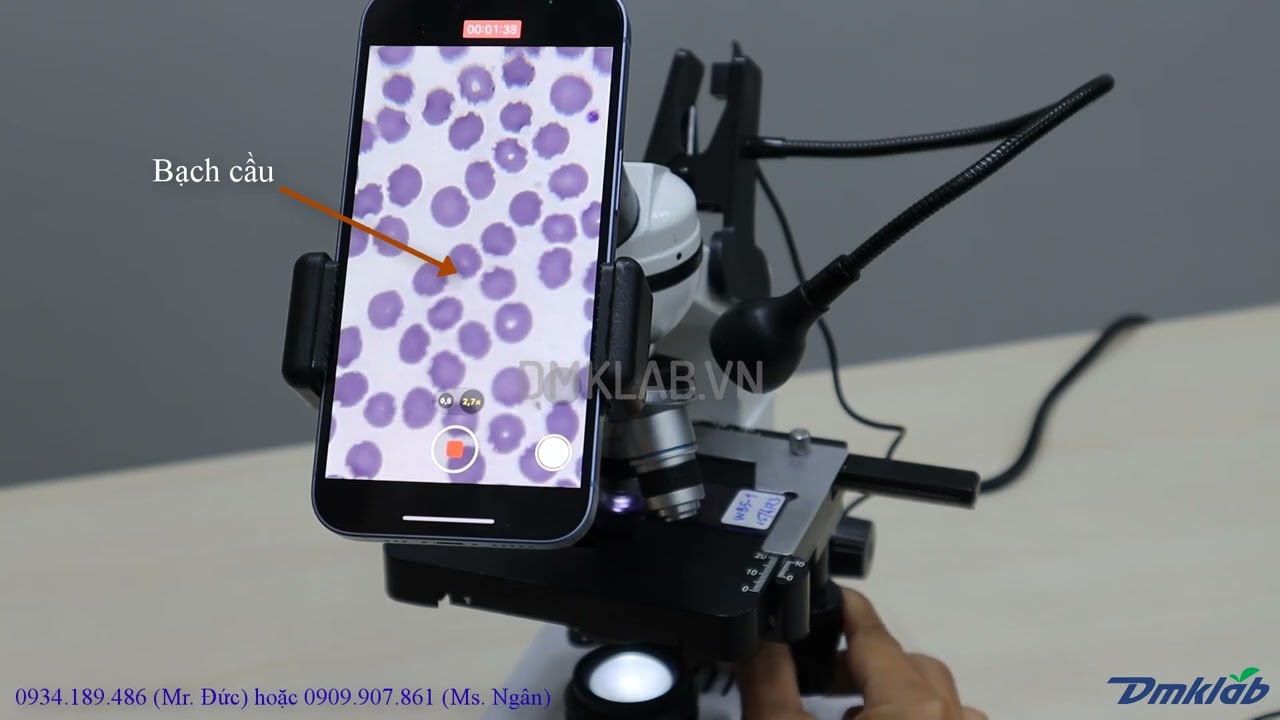 DMK483: Tiêu bản máu người - Human Blood under microscope