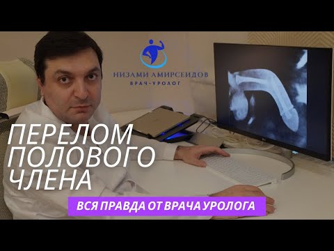 Что делать если сломался пенис. Вся правда о переломе полового члена