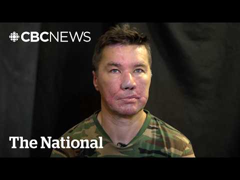 Ukrainian hockey player injured in war longs to return to game he <strong>loves</strong>