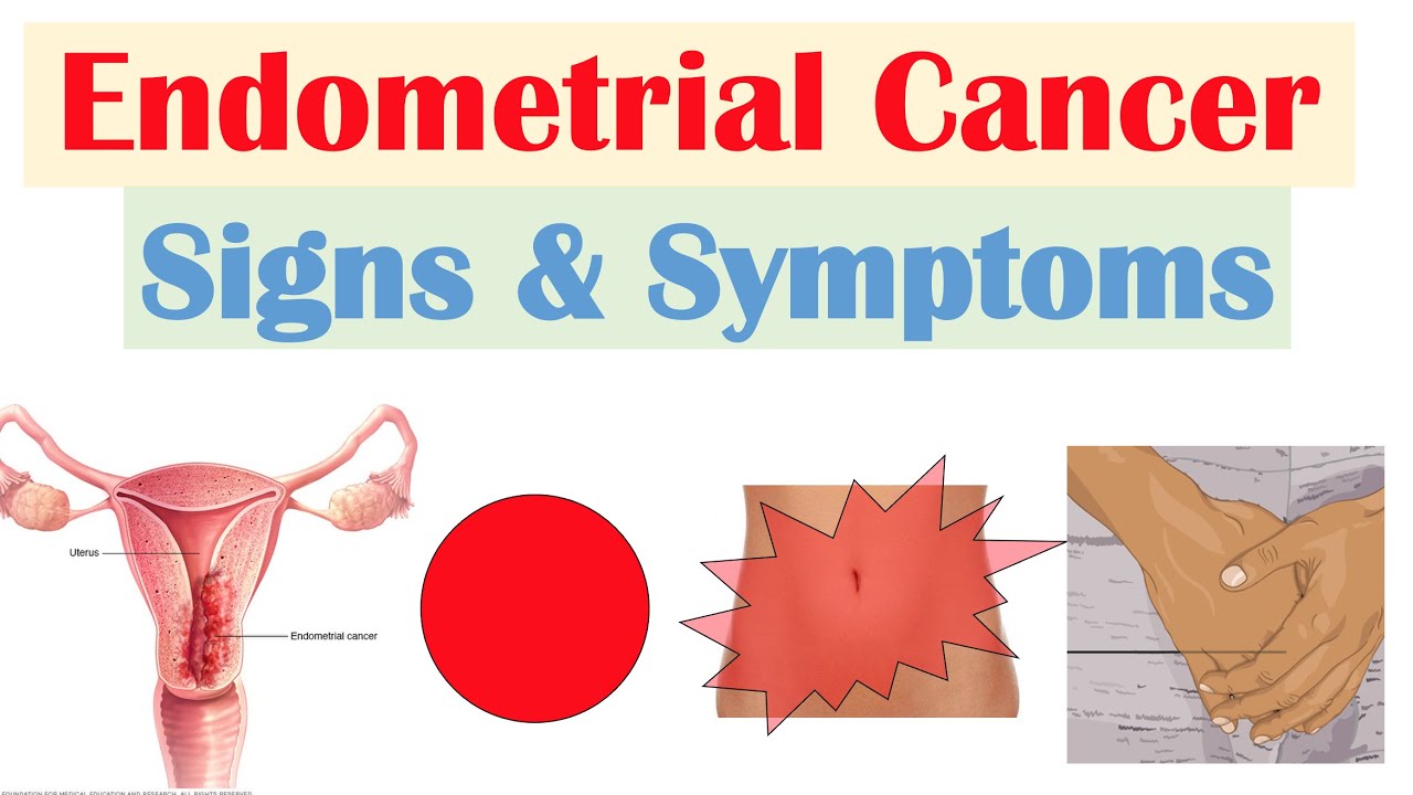 Endometrial Cancer Signs & Symptoms (& Why They Occur) 