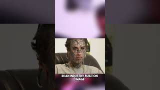 20 Celebrities With the Most Controversial Plastic Surgery Transformations 1