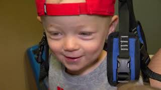 PEDIATRIC SPINAL CORD INJURY: LOCOMOTOR TRAINING GETS LUKE ON HIS FEET