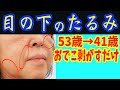 寝る前に騙されたと思って目の下のたるみを取る方法でおでこ剥がすだけでマジで驚くほどほうれい線消す・マリオネットラインが解消し眉間のシワが消える‼口元・目元の老化防止し若返る視力回復トレーニング