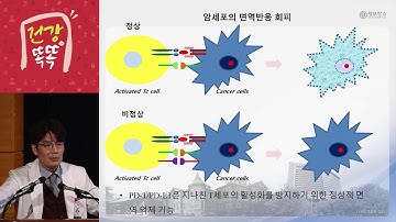 [건강똑똑 췌장암편] 1부. 췌장암 환자에게 희망이 되는 최신치료법_세브란스병원 방승민 교수