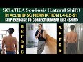 Sciatica Scoliosis, Lumbar Disc Herniation L4-L5-S1, Lateral Shift (LIST) Self Correction Exercise
