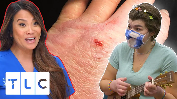 Eczema Patient Serenades Dr Lee During Appointment | Dr Pimple Popper