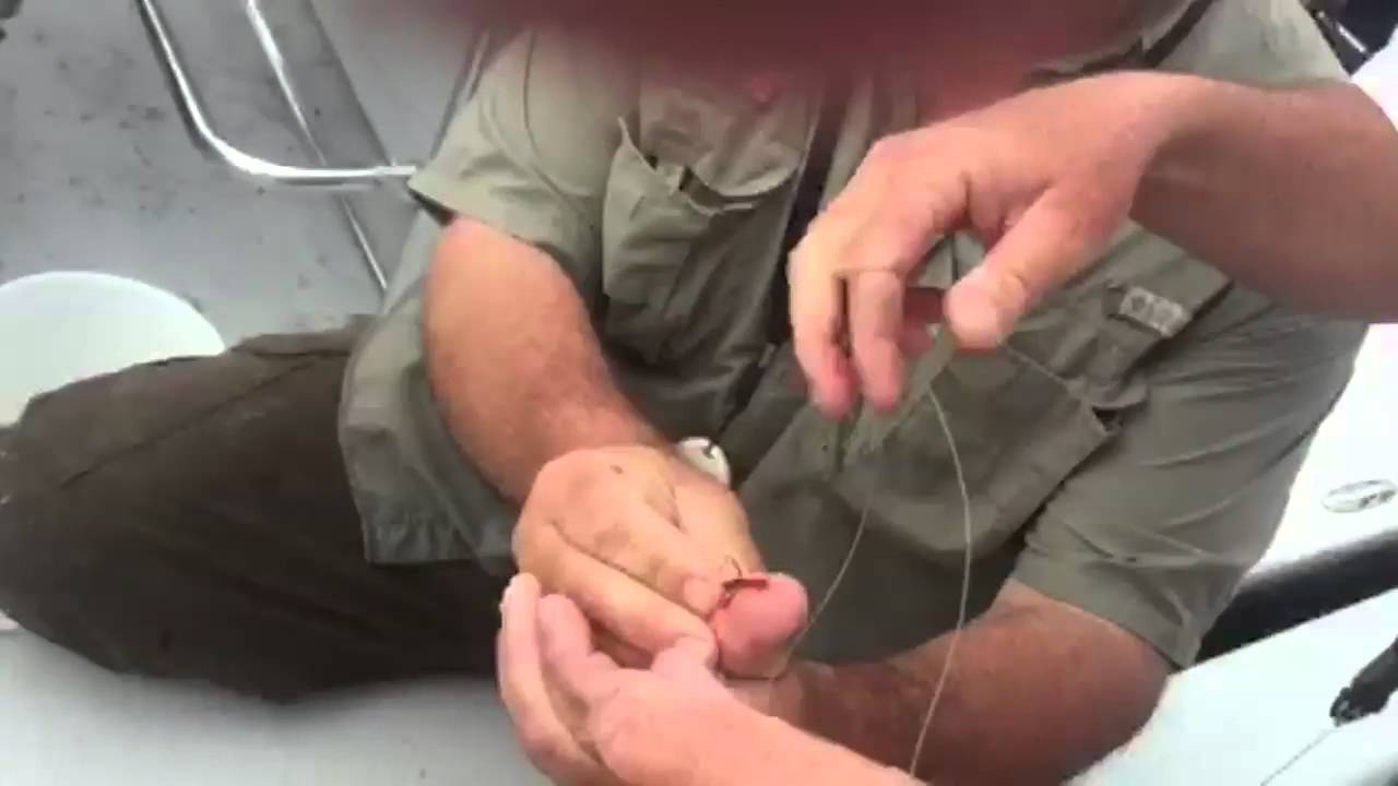 Watch guide use 'string trick' to pull treble hook out of finger 