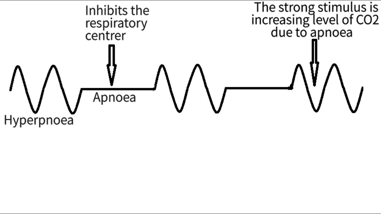 Biot's respiration - YouTube