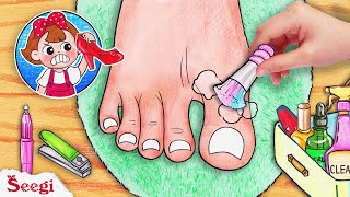 SEEGI Tries On Red Shoes | Funny Ingrown Toenail Removal | ASMR Stop Motion Paper