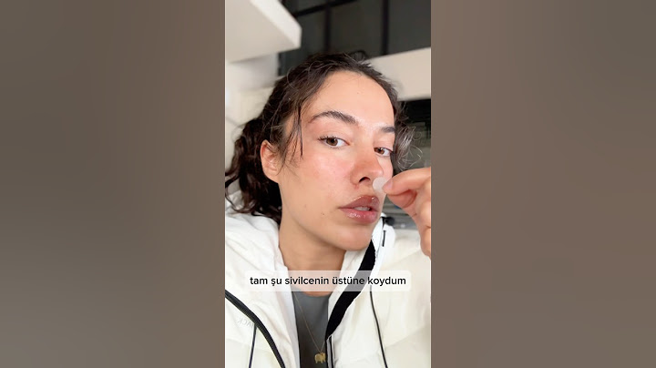 Sivilce bandı denedim ve sonuca çok şaşırdım
