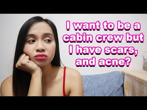 How To Cover Scars And Acne Instantly? | Cabin Crew Edition