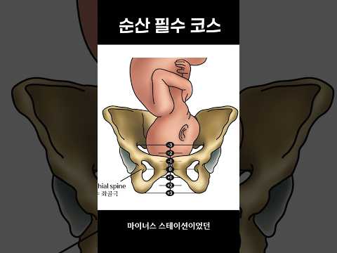 😭 #출산 #출산준비 #둘라 #<strong>자연분만</strong> #임산부