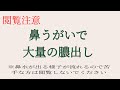 【閲覧注意】急性副鼻腔炎で鼻うがいをしたら、緑色のドロッとした膿が大量に出てきました
