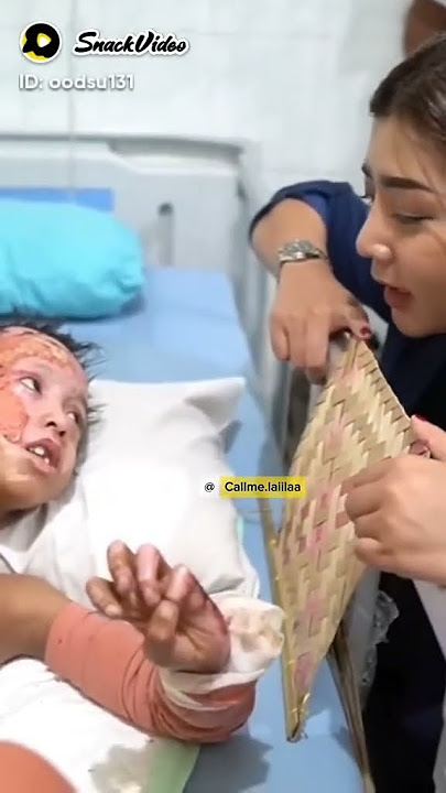 TUHAN YESUS  beriKan keKUATAN keSABARAN dalam MerasaKan SAKITnya 😭🙏 SNACK VIDEO