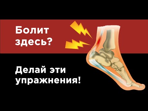 Видео: Как укрепить ахиллово сухожилие: 11 шагов (с иллюстрациями)