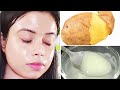 I used Potato Gel on my Face & it removed Dark Spots | Visible Glass skin in 2 days