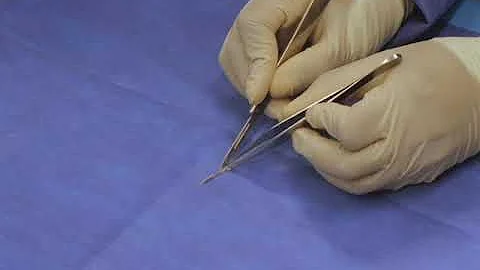 Bioness StimRouter Common Peroneal Nerve Procedure...