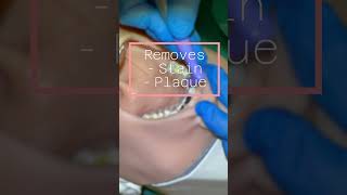 Coronal Polishing HS Demo