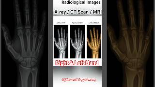 human X-ray CT Scan MRI Radiological Images #mri #radiology #mbbs #medical #shorts