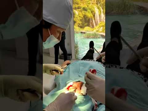 Video: Podizanje sredstava za kirurgiju pasa