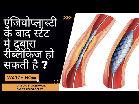 वीडियो: क्या लोइस स्टीवी को समझ सकती हैं?