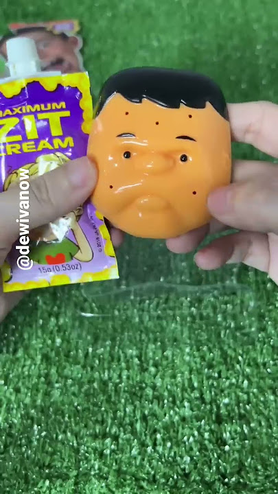for those who like to squeeze pimples #pimplesqueezing #dewivanow #blackheads #acne #satisfying