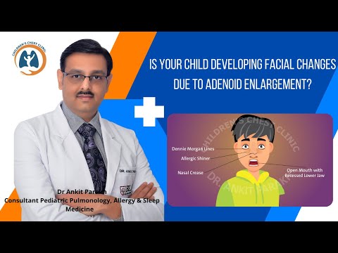 Facial changes due to Adenoid enlargement in children I Dr Ankit Parakh, Child Pulmonologist