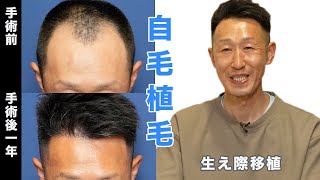 新世界2023年下半期生産★全人毛2023年最新人工頭皮9*14総手植え45㌢〜 新世界2023年下半期生産☆全人毛2023年最新人工頭皮9*14総手植え