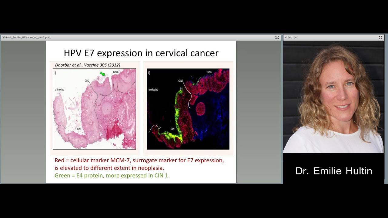 Lecture 2 (Part 2). Molecular Mechanisms of HPV induced cancer