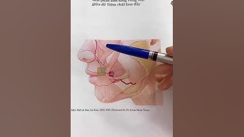 Học tiêm Filler & botox: Tắc mạch hoại tử khi tiêm rãnh cười