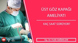 Üst Göz Kapağı Ameliyatı Kaç Saat Sürüyor ?