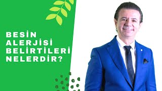 Besin alerjisi belirtileri nelerdir? Resimi