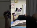 耳垢そうじ/耳が痒くなった鼓膜に付着した軟耳垢/#shorts