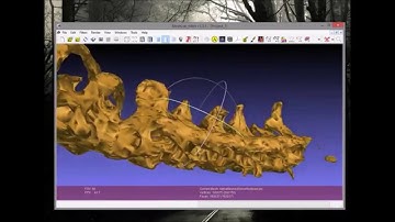 Medical Image Analysis, DICOM Viewer - Point Cloud 3D Reconstruction (TUKE)
