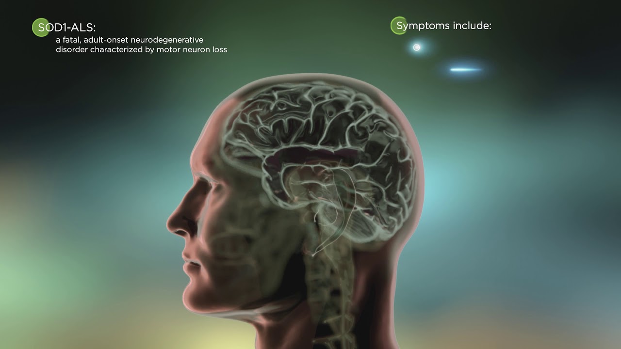 Mechanism of Disease: ALS