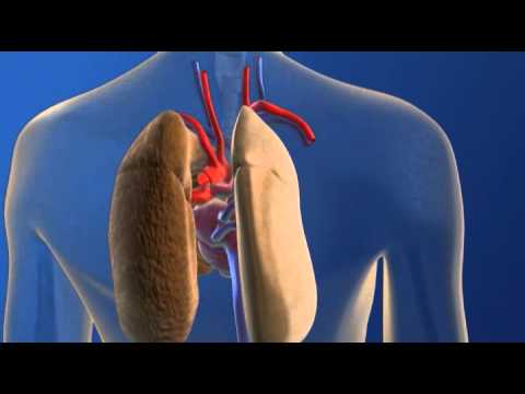 Lung Transplant - YouTube