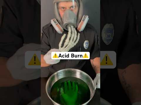 Burned by acid? Try this… #survival #health #medical