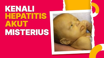 Kenali Hepatitis Akut Misterius