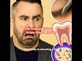 Gross Body Facts You’ll Wish You Didn’t Know – For Facts’ Sake!