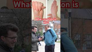 Doctor explains Marfan Syndrome #shorts