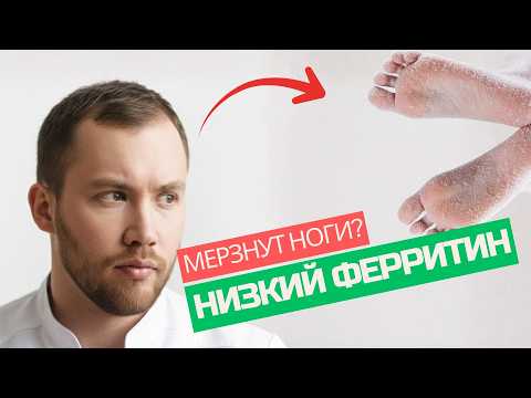 Мёрзнут руки и ноги? 4 ОПАСНЫЕ причины, о которых никто не говорит!