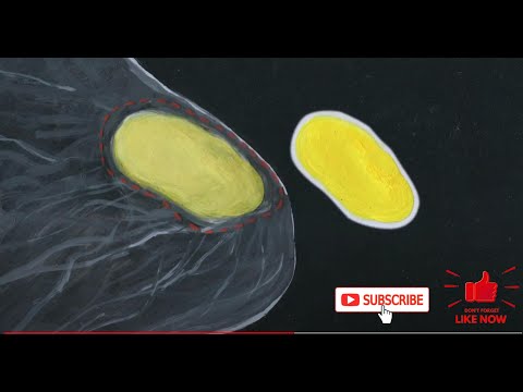 Video: Een Diepgaande, Op Beelden Gebaseerde, Intrinsieke Moleculaire Subtype-classificatie Van Borsttumoren Onthult Tumorheterogeniteit Die De Overleving Kan Beïnvloeden