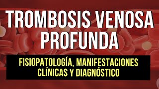 Trombosis Venosa Profunda | Fisiopatología, Manifestaciones Clínicas y Diagnóstico (Parte 1) 🩸