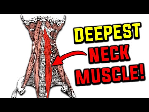 Relieve Neck Pain Headaches By Activating This Deep Muscle