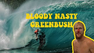 BIG NASTY GREENBUSH, IS THIS THE HEAVIEST SURF SESSION EVER IN THE MENTAWAIIS? | VON FROTH