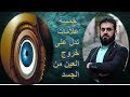 خمسة علامات تدل على خروج العين من الجسد ؟