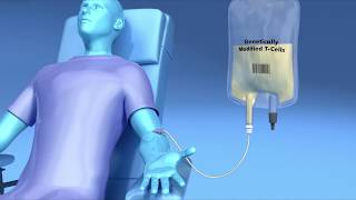 CAR T at Moffitt Cancer Center: Immunotherapy to Fight Disease