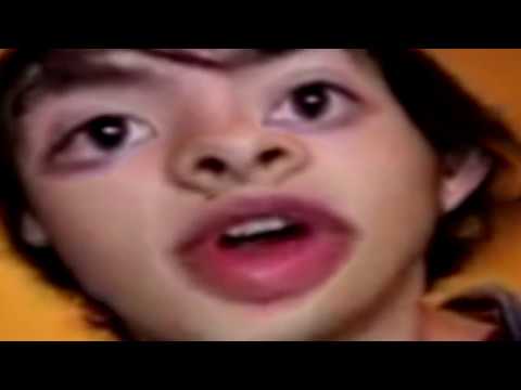 put the chromosomes in the bag