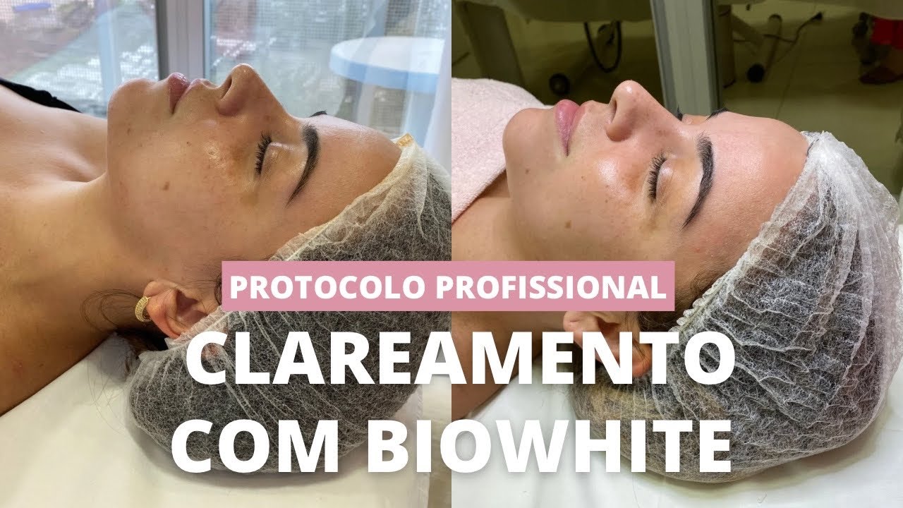 CLAREAMENTO FACIAL COM BIOWHITE TULÍPIA - PASSO A PASSO | Thayná Oliveira