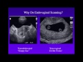 Sonography of Twins